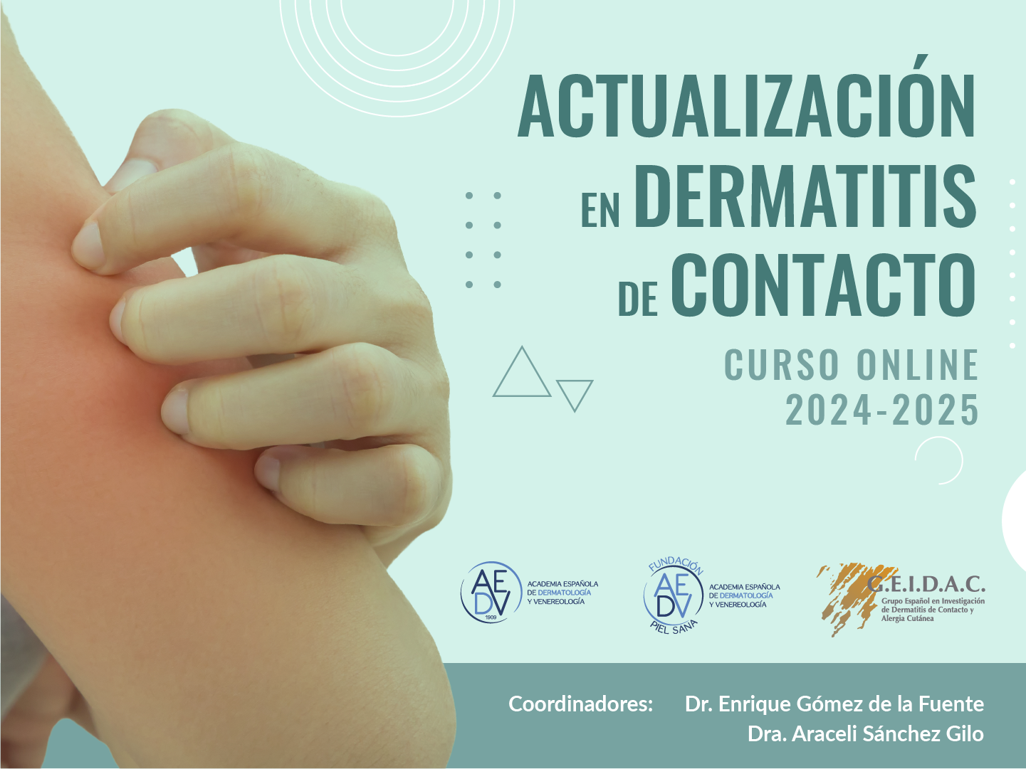 Curso de Actualización en Dermatitis de Contacto