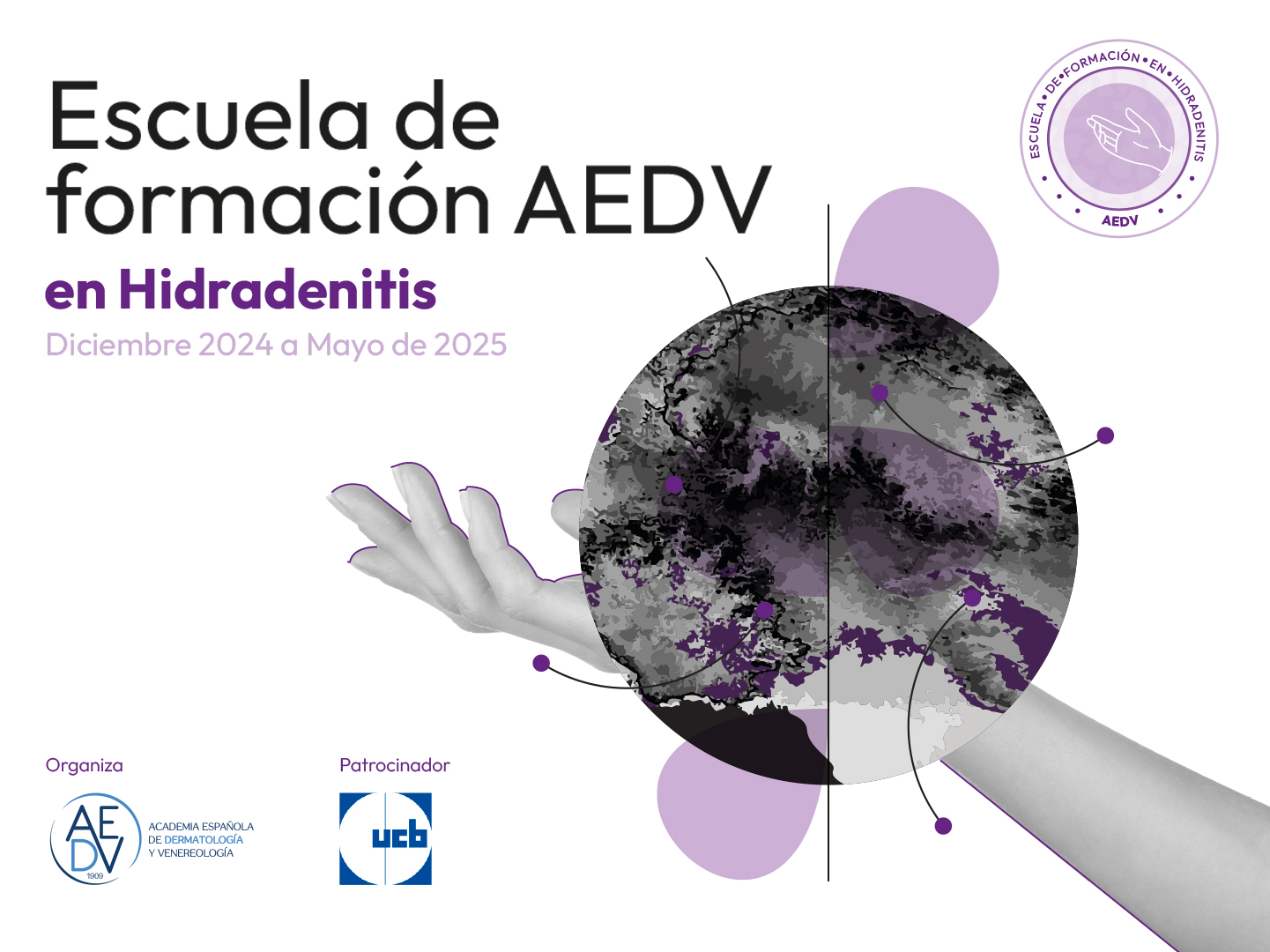 Escuela de formación AEDV en Hidradenitis