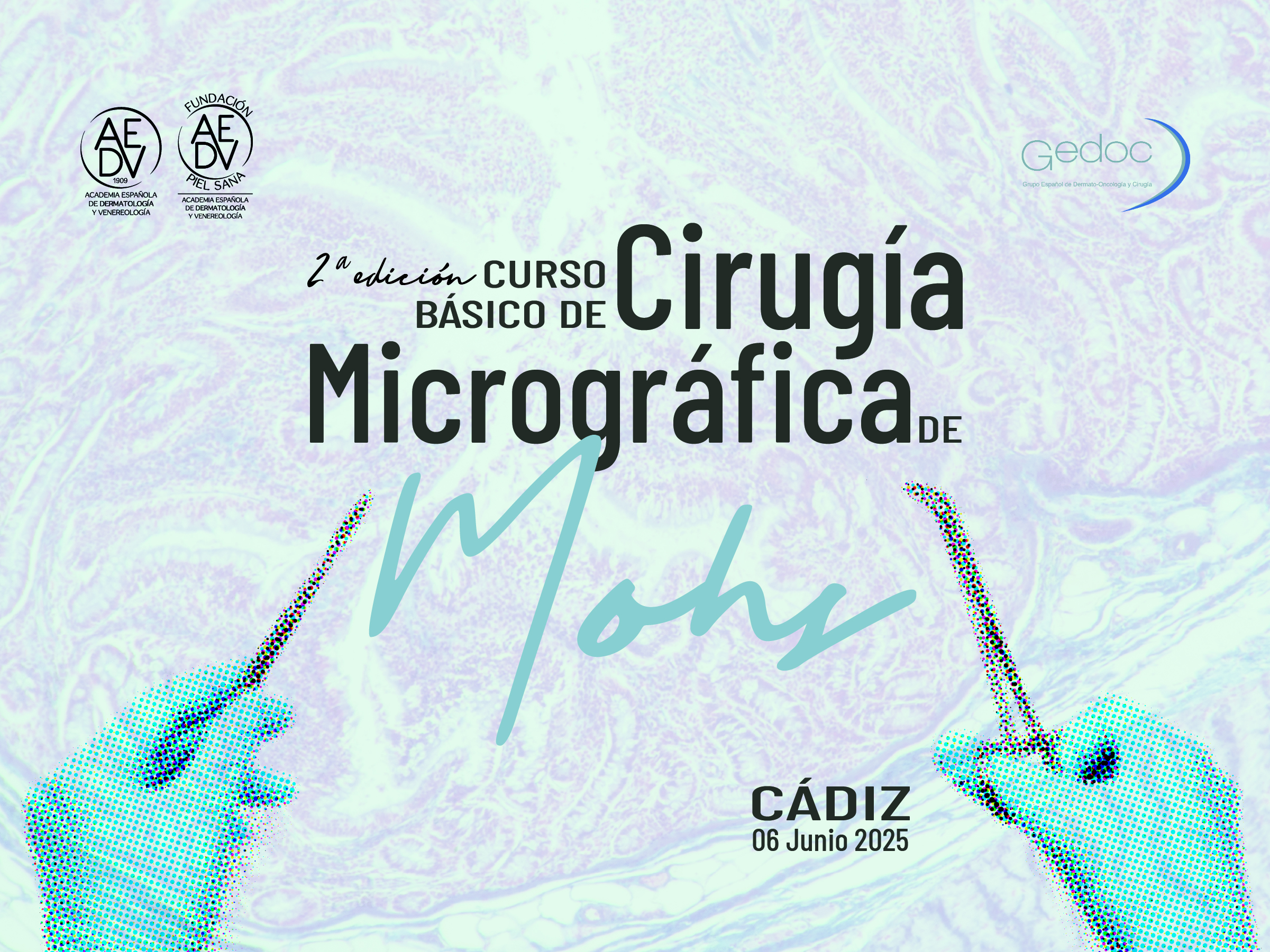 II Curso Básico de Cirugía Micrográfica de Mohs